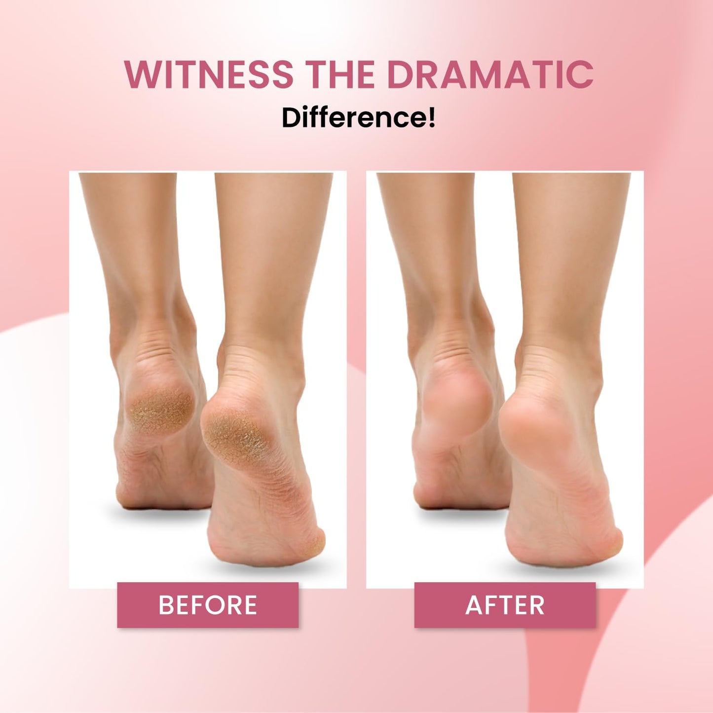 Urban Yog Brazilian Face Wax - Facial hair removal