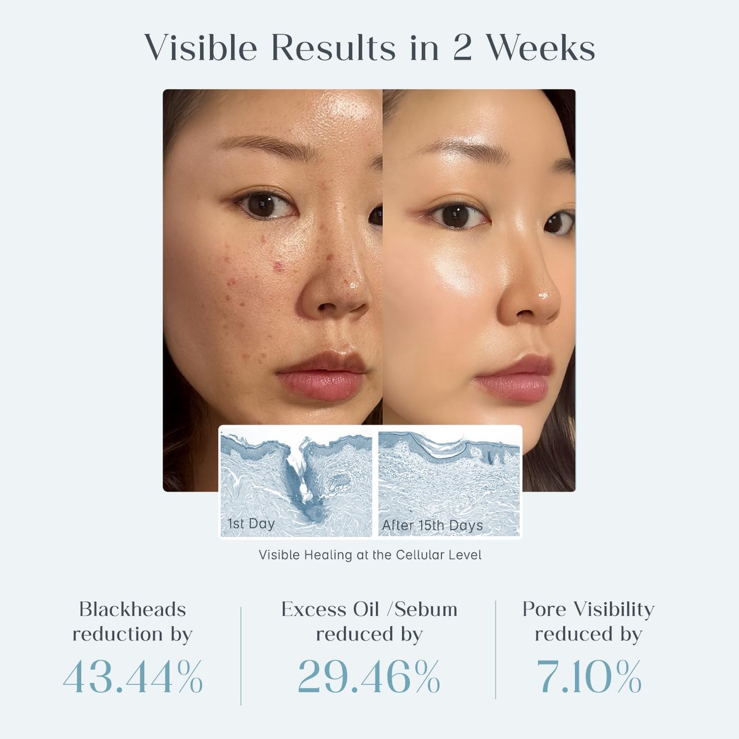 Seoul Skin Zero Pore Pads - Post-workout refresh