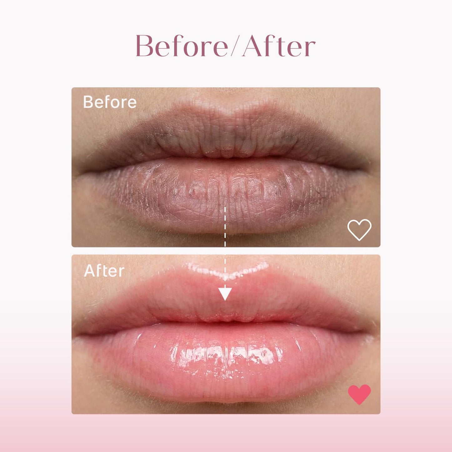 Seoul Skin brightening lip balm - daily hydration for chapped lips