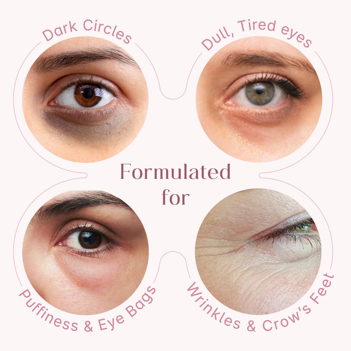 Seoul Skin eye cream - reduces dark circles effectively