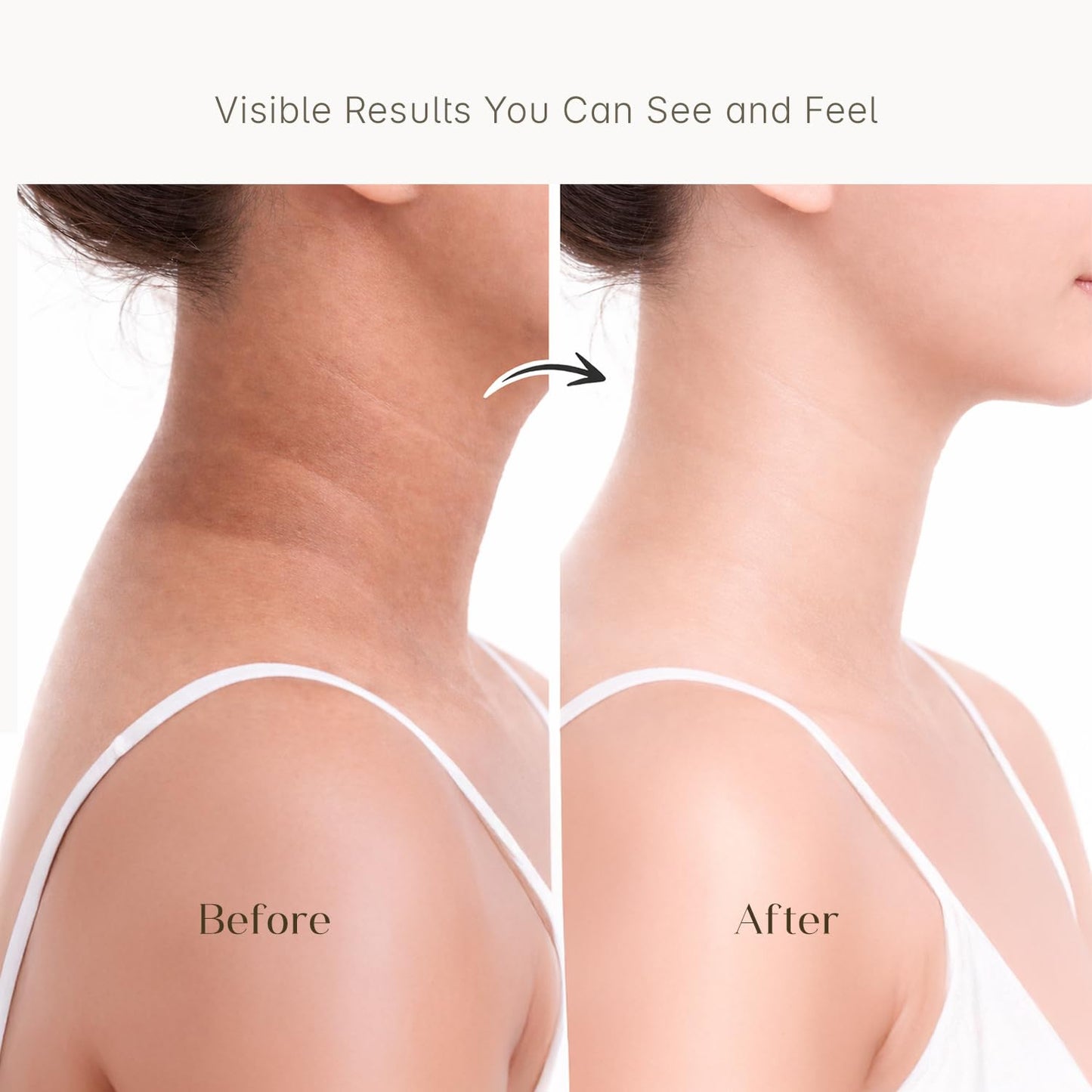 Seoul Skin Kojic & Rice Water Soap - Daily use bath soap