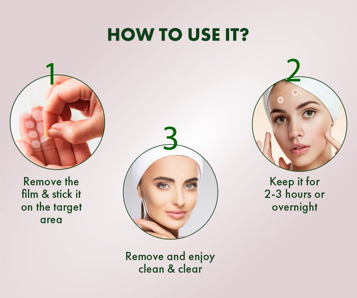 Urban Yog facial kit - Easy acne treatment