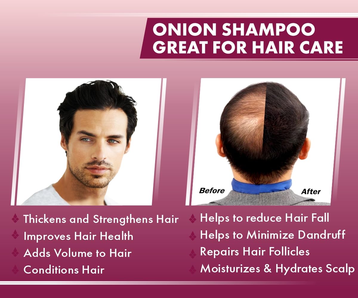 Urban Gabru Red Onion Shampoo - Anti-Dandruff Solution