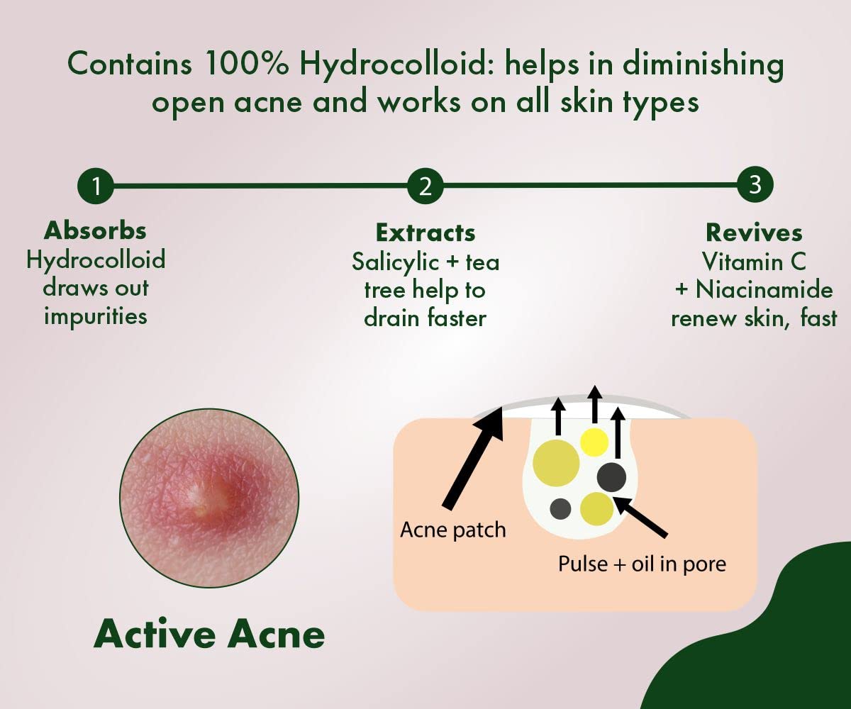 Urban Yog Acne Pimple Patch - Easy application for clear skin