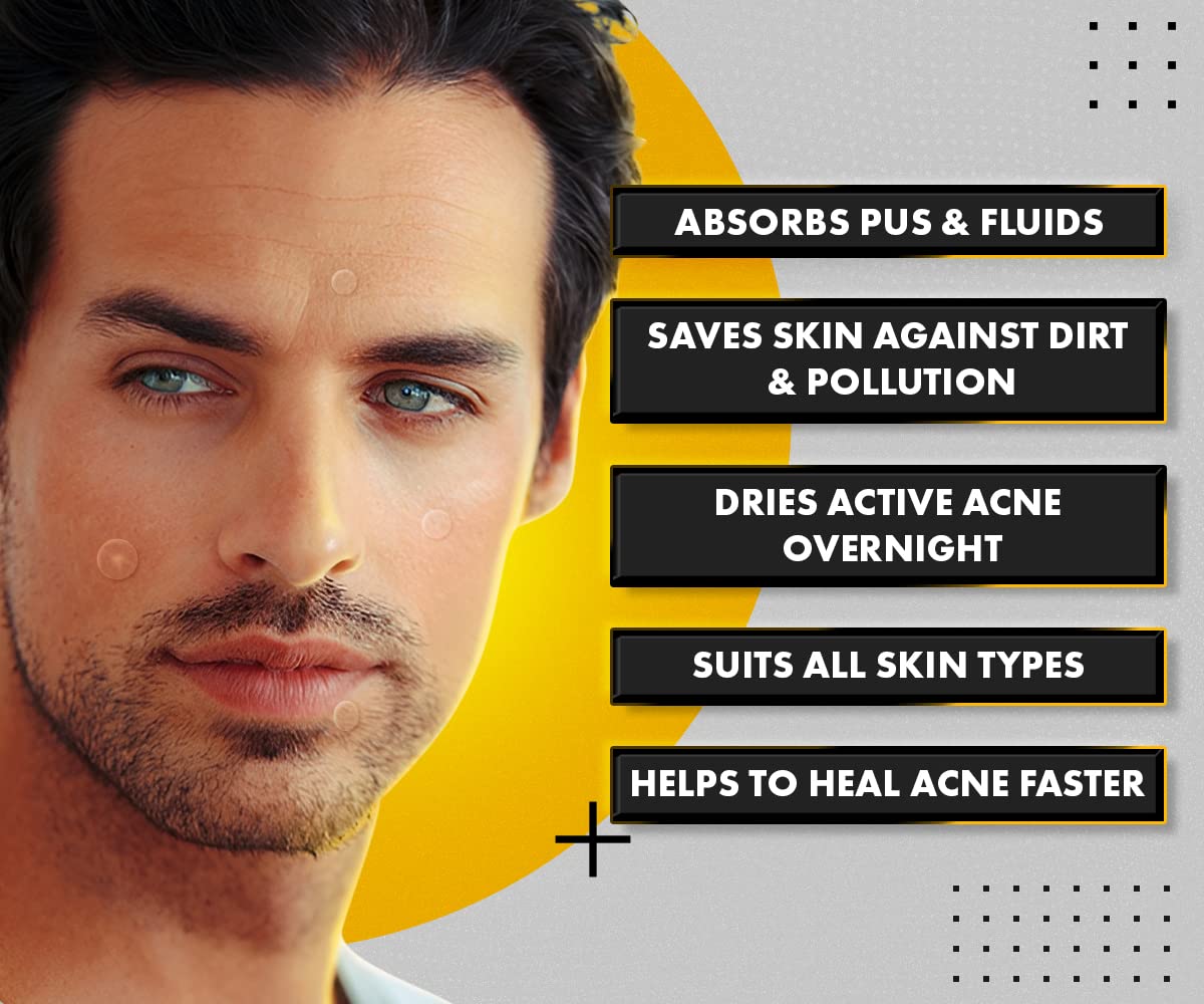 UrbanGabru Acne Pimple Patch - Essential item for travel skincare