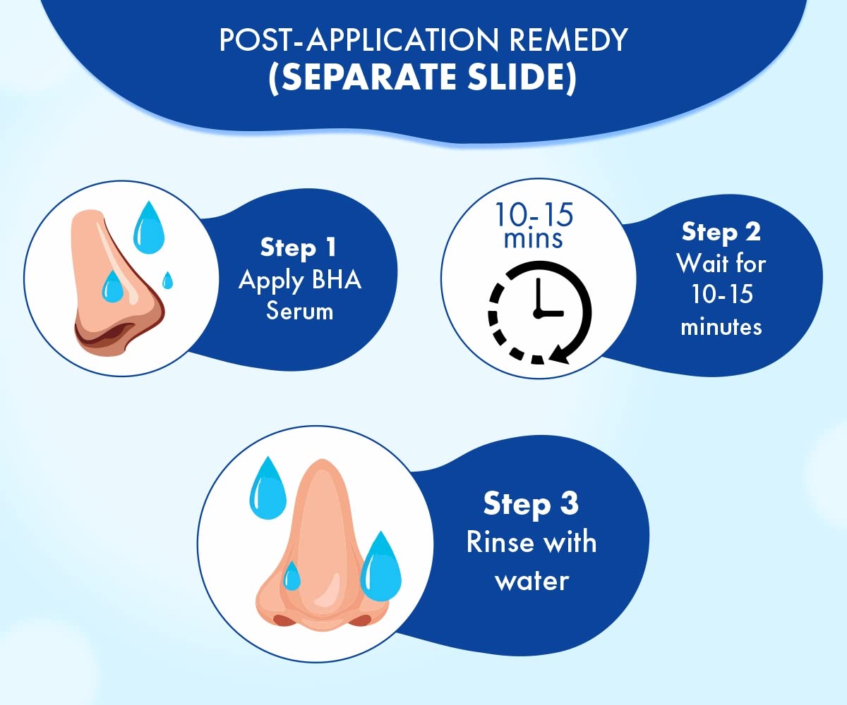 Urban Yog Nose Strips - Blackhead removal for all skin types